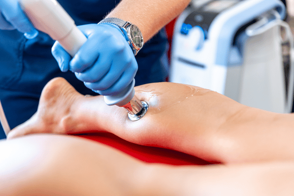 What is Extracorporeal Shockwave Therapy