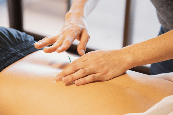 Frankston Dry Needling