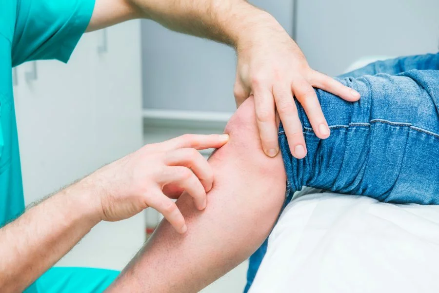 Knee Bursitis Treatment